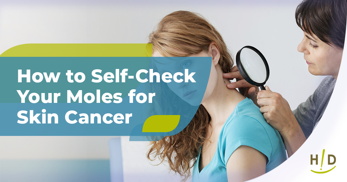 How to Self-Check Your Moles for Skin Cancer