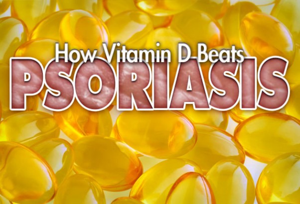 How Vitamin D Beats Psoriasis