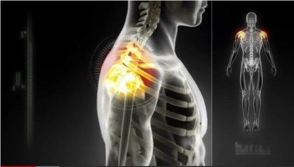 How Boswellia Affects Your Joints