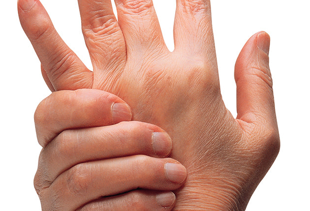 A Natural Solution for Getting Rid of Gout