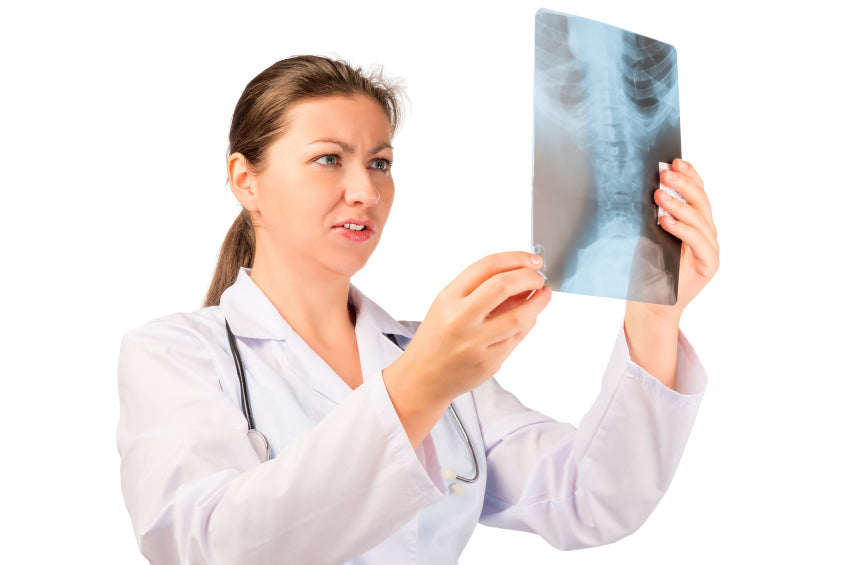 Important Steps to Prevent Osteoporosis and Maintain Healthy Bones