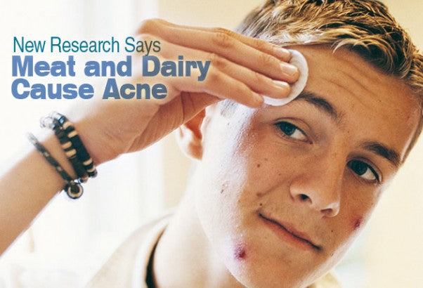 New Research Says Meat and Dairy Cause Acne