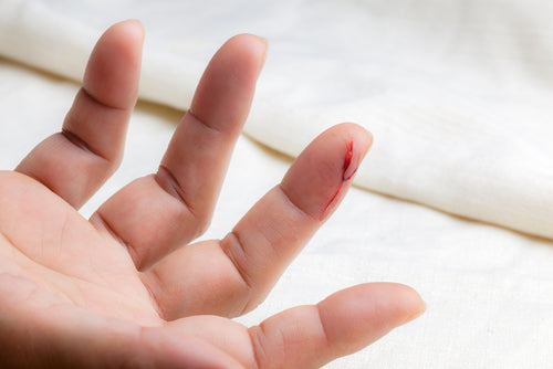 injured finger with open cut