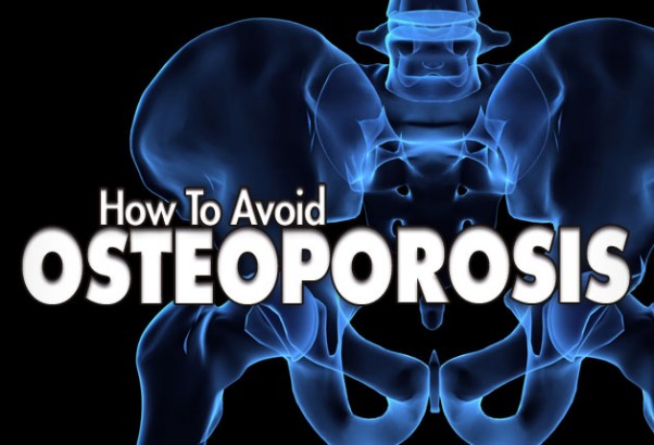 How To Avoid Osteoporosis